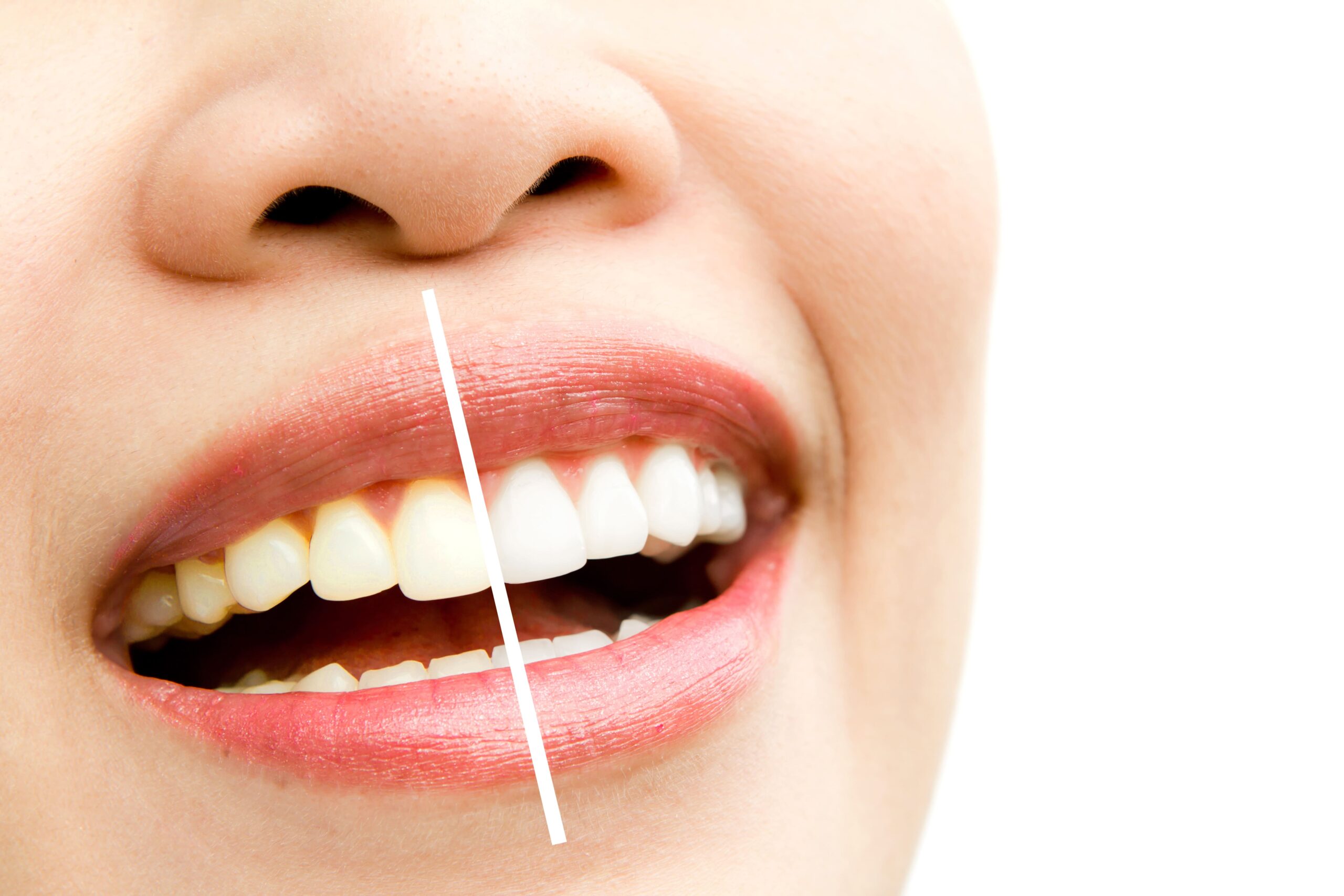 Ultimate Guide to Smile Correction at Phoenix Multispecialty Dental Clinic