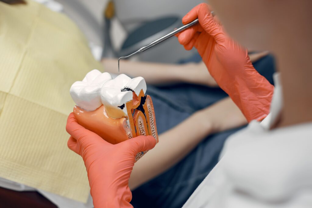re-root canal treatment