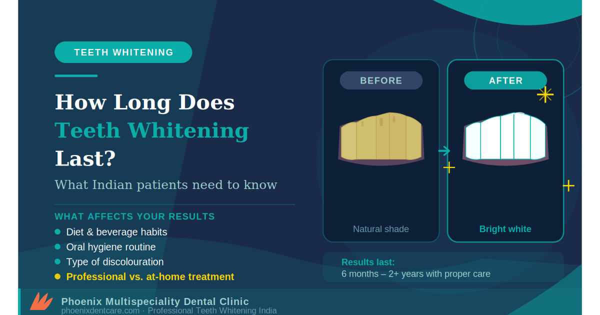 How Long Does Teeth Whitening Last? What Indian Patients Need to Know
