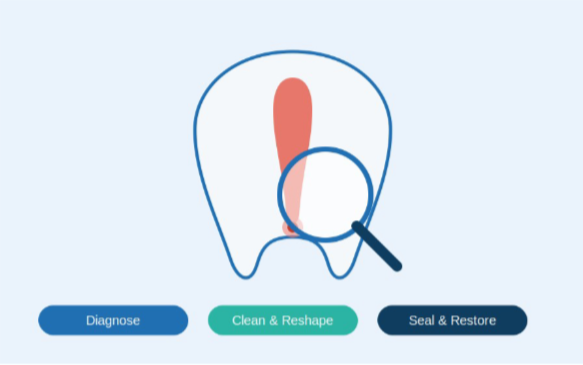 Root Canal Retreatment: When You Need It and What to Expect